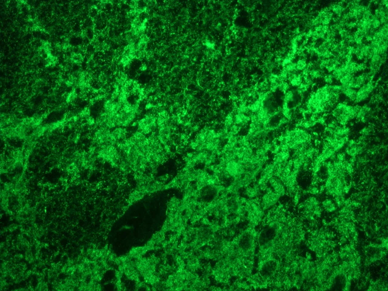 Figure 1. Indirect immunofluorescence staining of reticulon-1C (NSP-C) in frozen tissue section of rat brain using MUB1315P (RNL-4; diluted 1:1000).